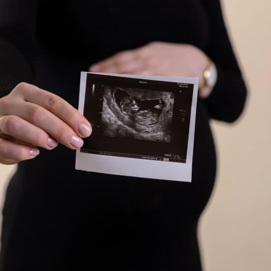Pregnant woman holding ultrasound scan at fertility clinic